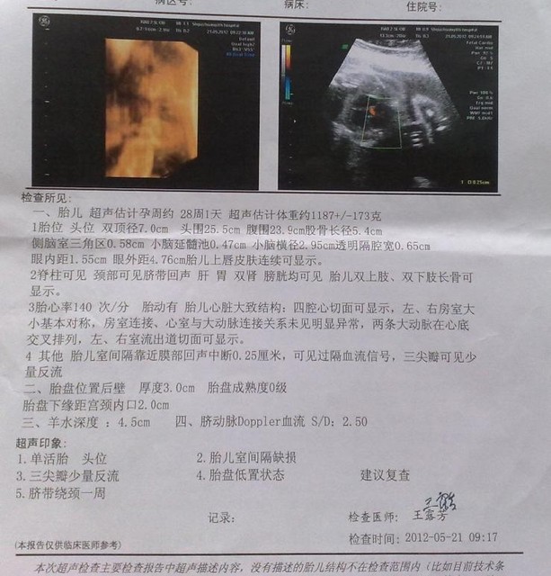 &nbsp;&nbsp;&nbsp;&nbsp;&nbsp;&nbsp; 各位宝妈有28周的数据方便的