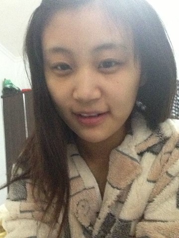 母乳的妈妈有黑眼圈了吗_育儿问答_宝宝树