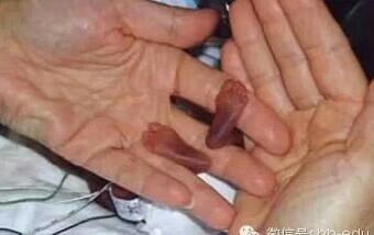 22周胎儿的真实样貌,只有感动!