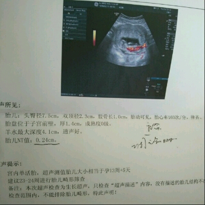 三个月去产检,胎儿的nt值是0.