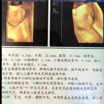 journal_insert_pic_556024557