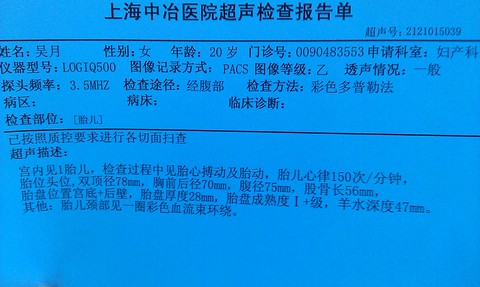 宝妈们,发双顶径,算宝宝体重啦!听说和医生算的差不多哦