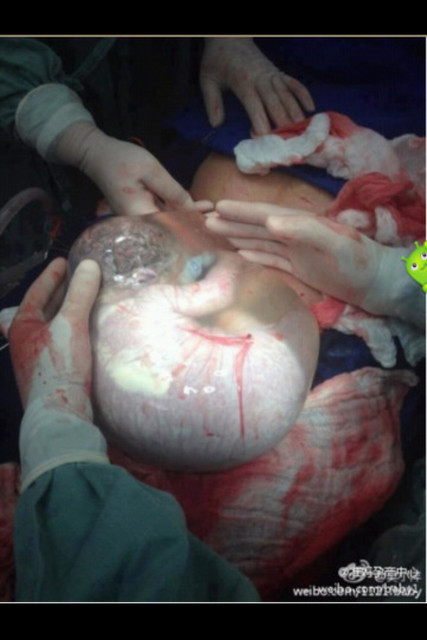 听说宝宝在妈妈肚子里是这样的 (血腥)