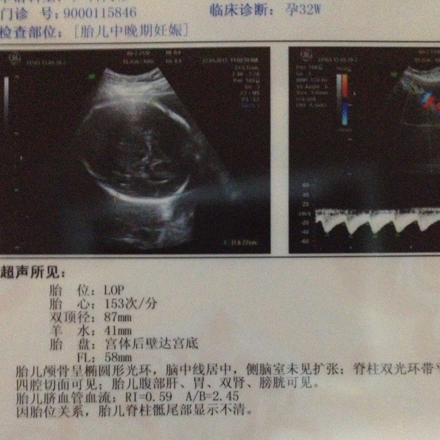 32周b超 宝宝头大吗 体重怎么算 宝宝树