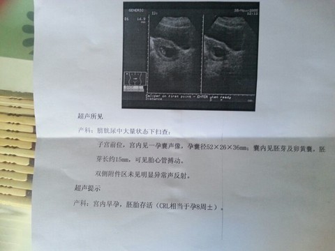 journal_insert_pic_121880290