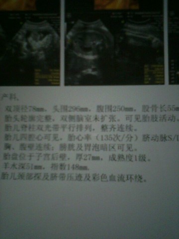 journal_insert_pic_121991603