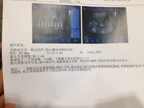 journal_insert_pic_122283626