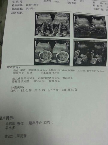 journal_insert_pic_123692287