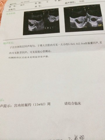 journal_insert_pic_125676694