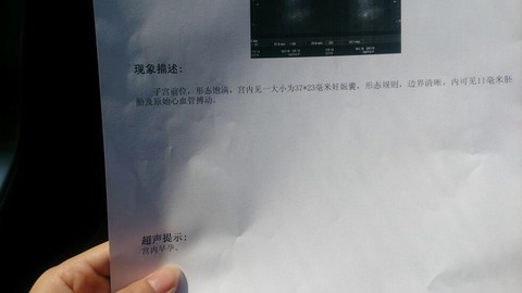 journal_insert_pic_126529561