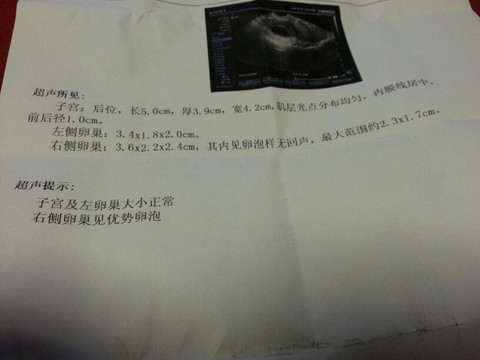 journal_insert_pic_127208600