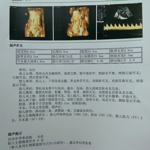 journal_insert_pic_127750883