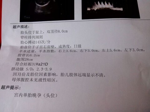 journal_insert_pic_127702322