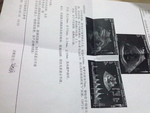 journal_insert_pic_128565558