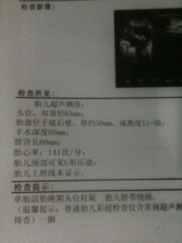 journal_insert_pic_129419533