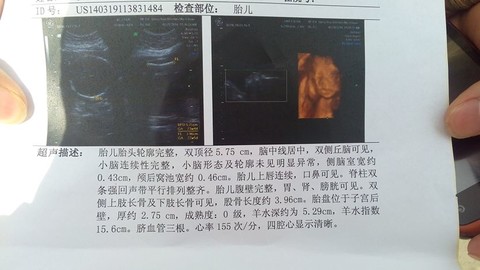 journal_insert_pic_129526791