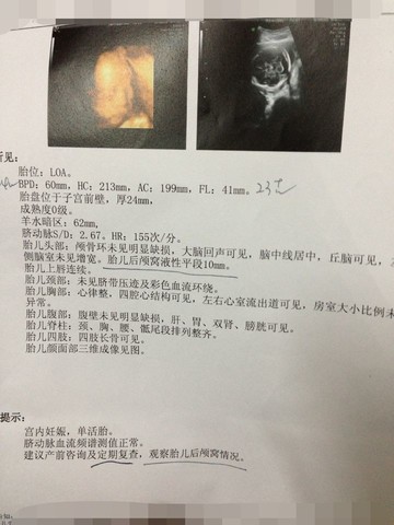 journal_insert_pic_129560043