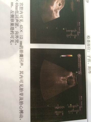 journal_insert_pic_130290181