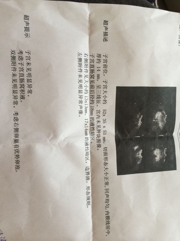 journal_insert_pic_131035236