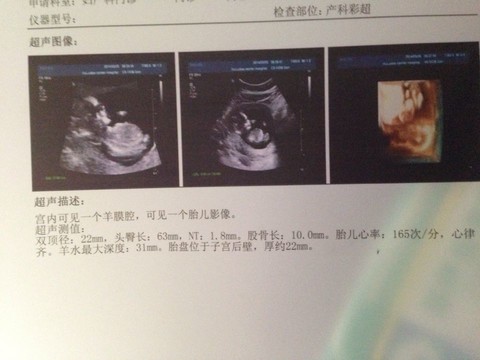 journal_insert_pic_131402108