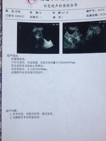 journal_insert_pic_134319238