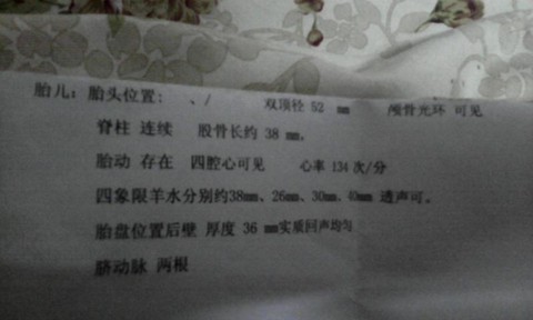 journal_insert_pic_134590846