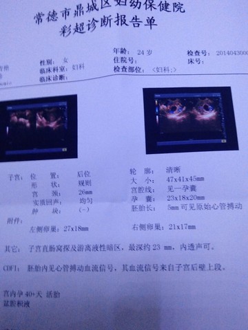 journal_insert_pic_134982102