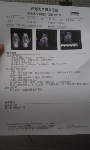 journal_insert_pic_135404526