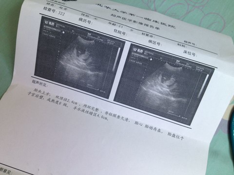 journal_insert_pic_135641306