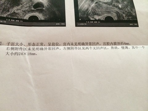 journal_insert_pic_136989951
