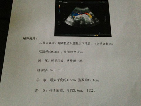 journal_insert_pic_138033451
