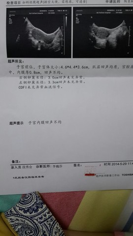 journal_insert_pic_138770318