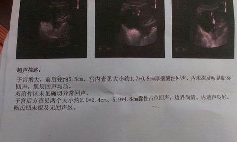 journal_insert_pic_138904813
