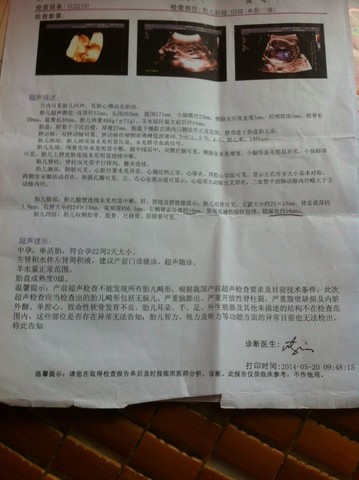 journal_insert_pic_139785321