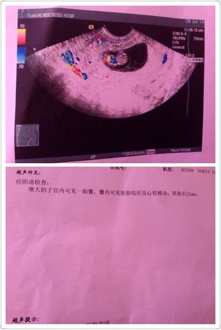journal_insert_pic_140038105