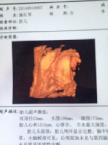 journal_insert_pic_140501829