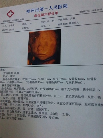journal_insert_pic_140434136