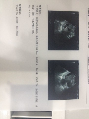 journal_insert_pic_140430511