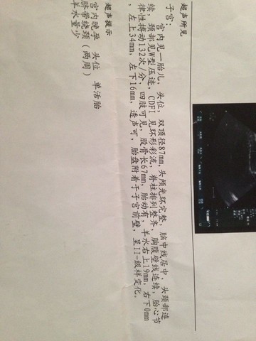 journal_insert_pic_140738794