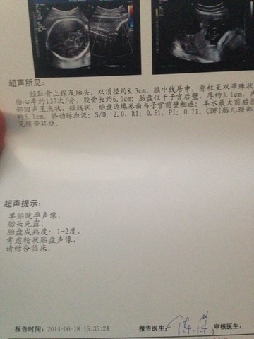 journal_insert_pic_141378013