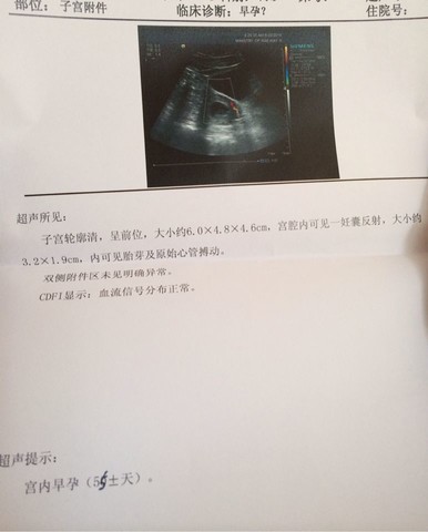 journal_insert_pic_141574633