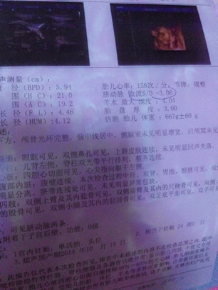 journal_insert_pic_142686543