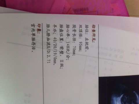 journal_insert_pic_143593827