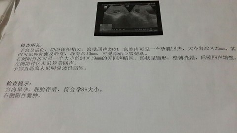 journal_insert_pic_143888882