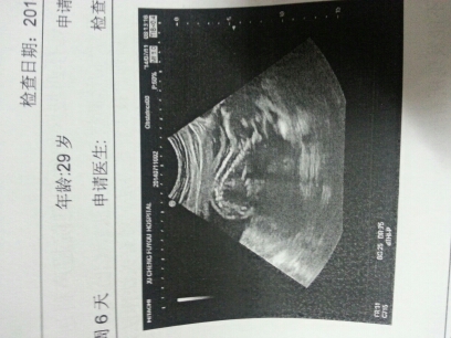 journal_insert_pic_144052954