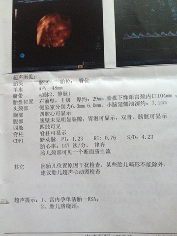 journal_insert_pic_144258438