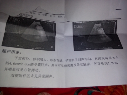 journal_insert_pic_144178048