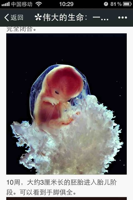十周的婴儿胚胎