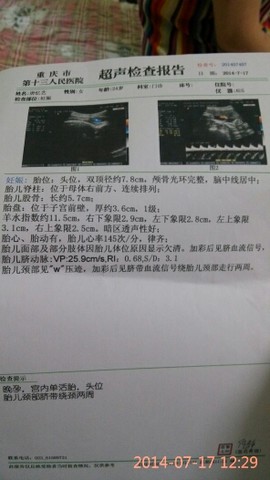 journal_insert_pic_144893630