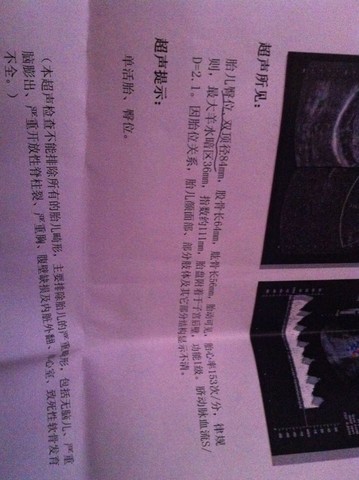 journal_insert_pic_146420407
